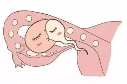 42岁二胎妈妈